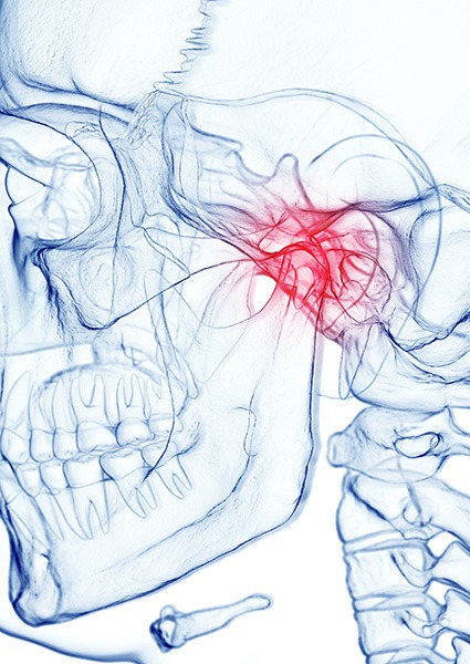 Temporomandibular joint highlighted on illustration of human skull