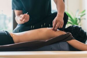 Practitioner carefully inserting acupuncture needles in patient’s back